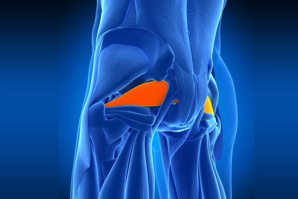 سندرم پیریفورمیس