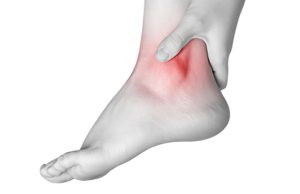 آرتروز مچ پا