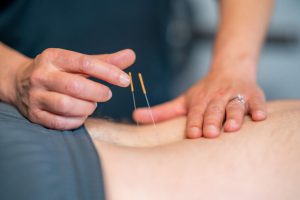 سوزن خشک در تجریش